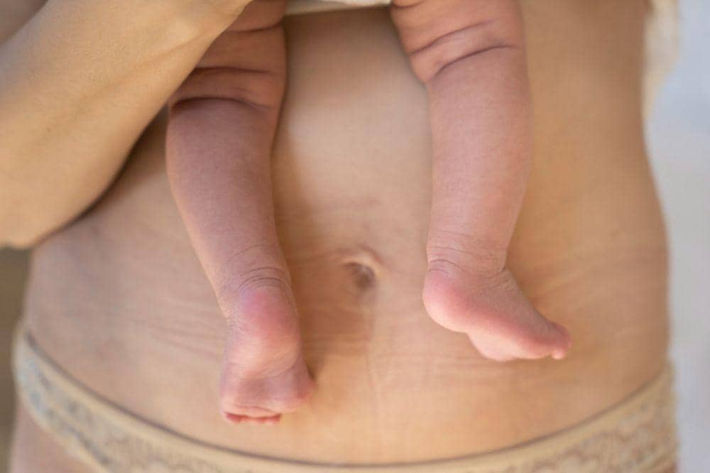 7 Cara menghilangkan perut gelambir pasca melahirkan