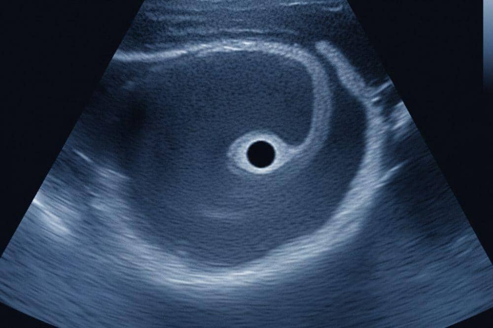 Popmama.com/Alya Putri Abi/AI