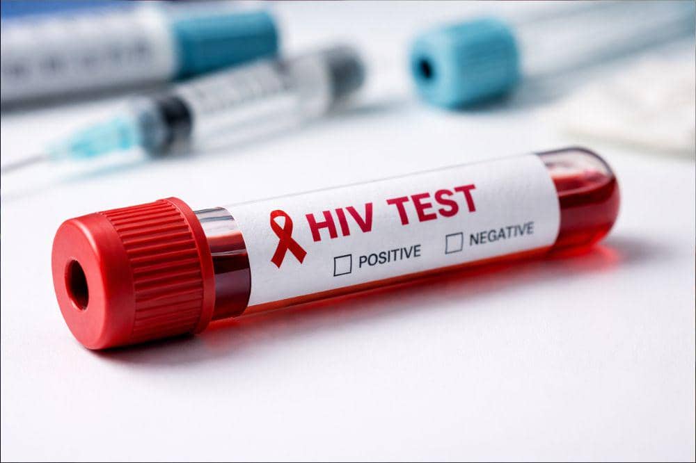 Pentingnya tes kesehatan wajib sebelum promil 