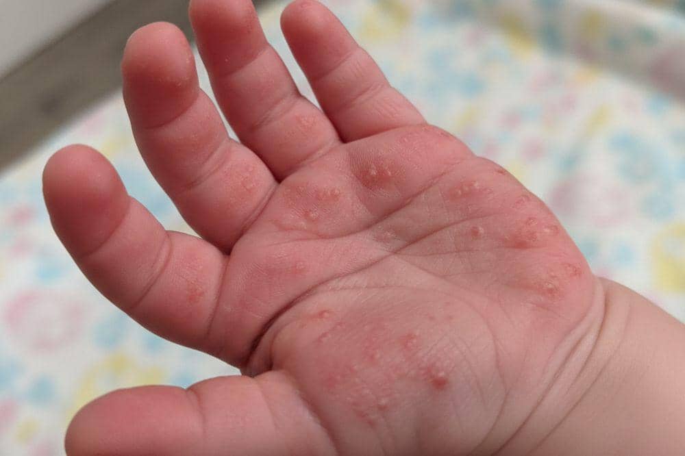 Popmama.com/Alya Putri Abi/AI