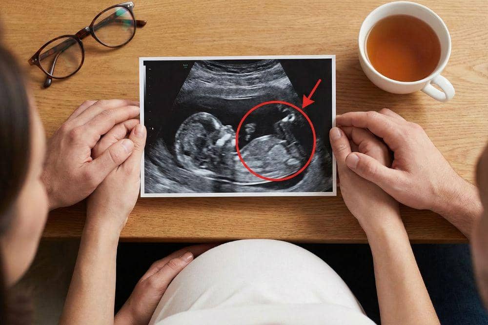 7 Bahaya Ibu Hamil Kekurangan Kalsium 3