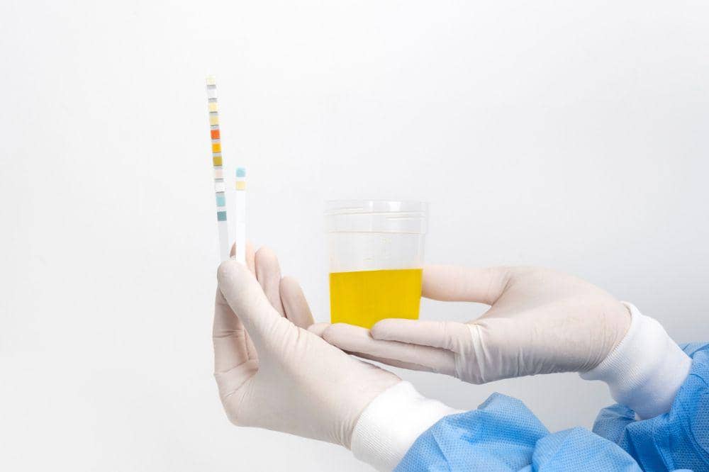 Sebelum bulan puasa cek kesehatan untuk tubuh siap hamil 