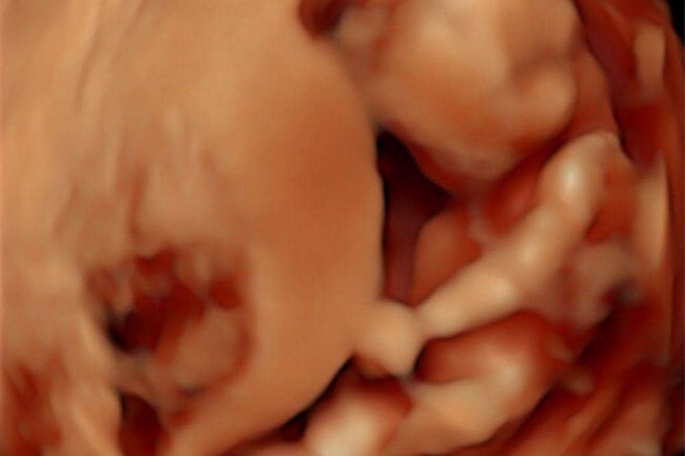 Instagram.com/indhningtys