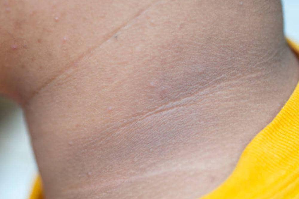 6 Penyebab Leher Hitam yang Jarang Diketahui