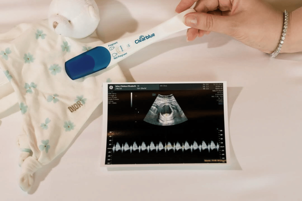 Instagram.com/chelseaislan