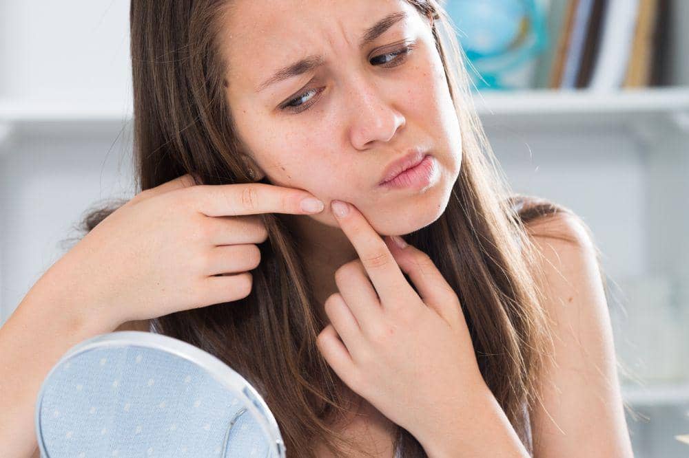 7 Bahaya Memencet Jerawat