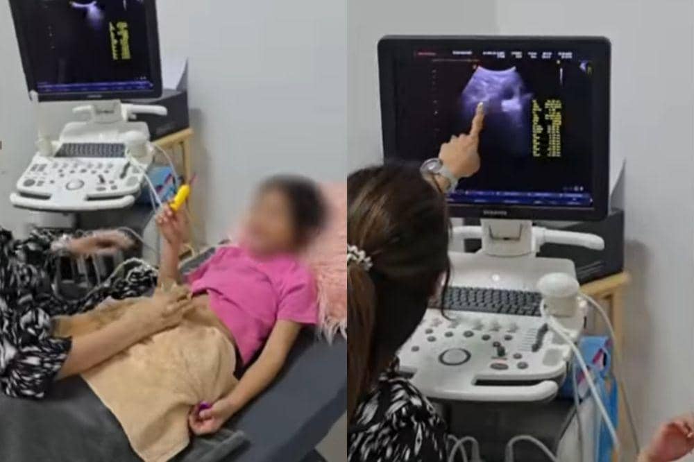 viral anak 9 tahun di filipina hamil