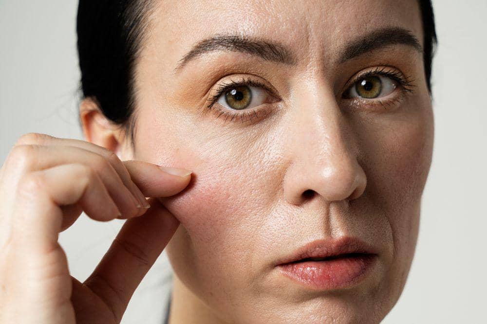 Perbedaan Kulit Dehidrasi dan Kulit Kering yang Sering Disalahartikan