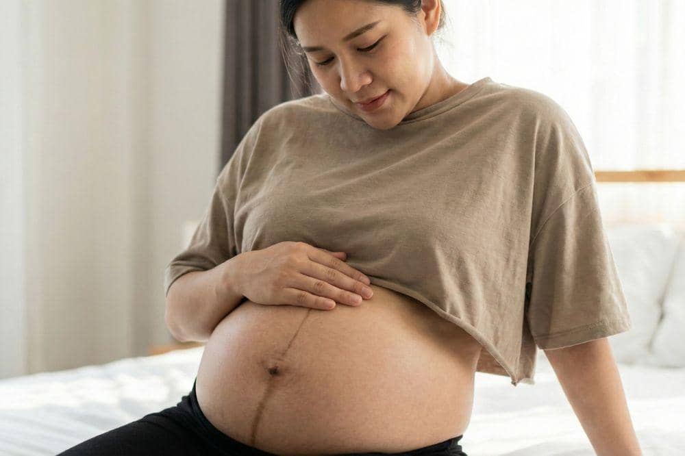 9 Penyakit Kulit yang Sering Terjadi saat Hamil 5