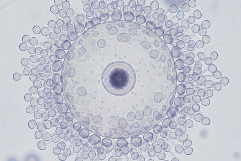 Apakah Sel Telur Perempuan Bisa Habis