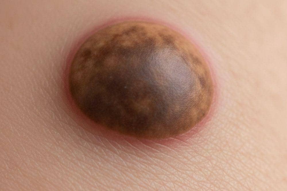 Popmama.com/Alya Putri Abi/AI