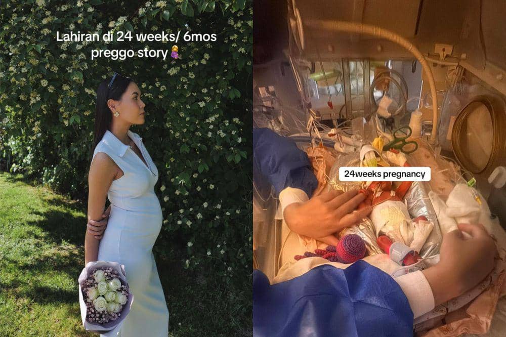Cerita Haru Ibu Hamil Harus Melahirkan di Usia 24 Minggu Kehamilan