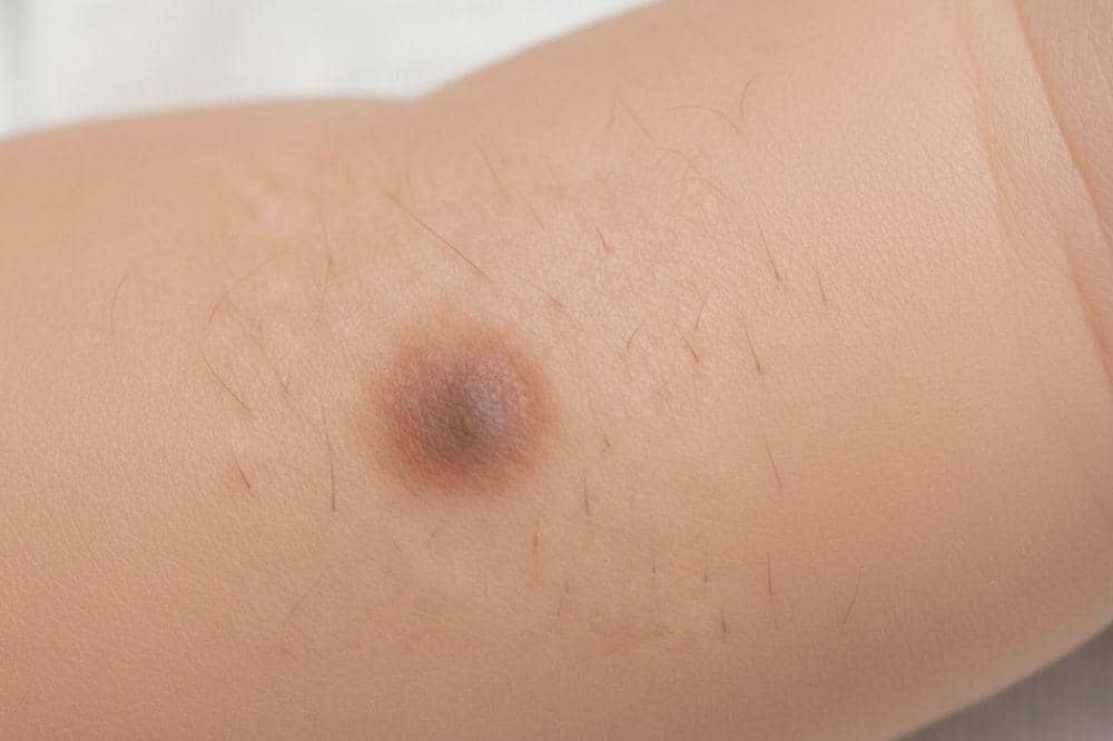 Popmama.com/Alya Putri Abi/AI