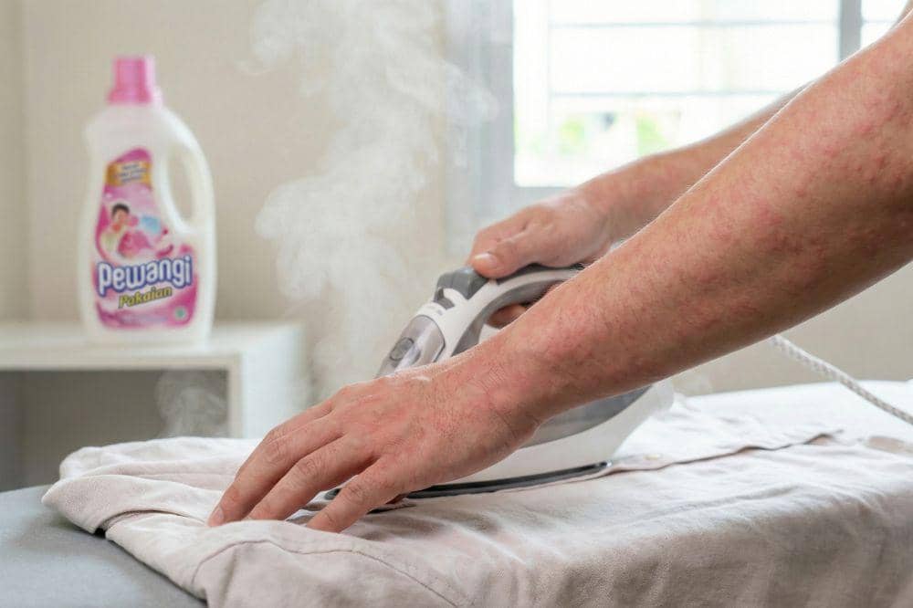 dr. Danar Ungkap Biduran Bisa Jadi karena Pelicin dan Pewangi Pakaian 1