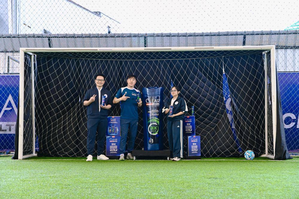 Kata Coach Shin Tae-yong soal Pentingnya Kulit Kepala Sehat 1