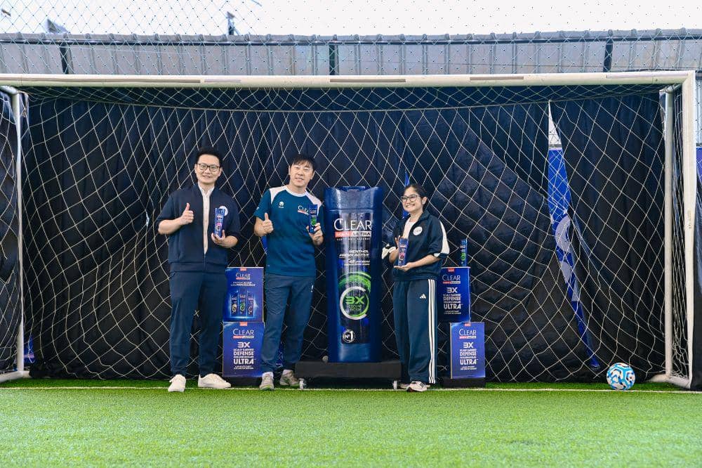 Kata Coach Shin Tae-yong soal Pentingnya Kulit Kepala Sehat 3
