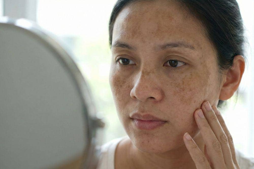 7 Penyebab Wajah Kusam saat Hamil 7