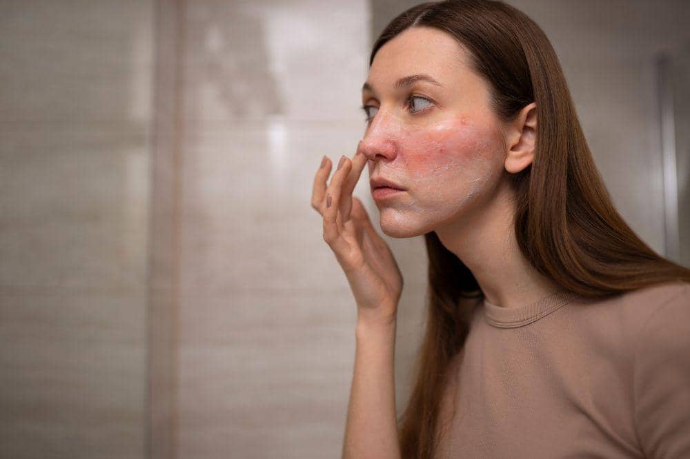 7 Penyebab Kulit Wajah Memerah saat Hamil 1