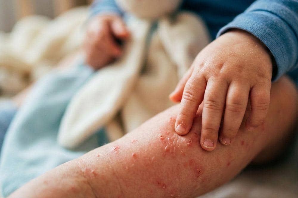 Popmama.com/Alya Putri Abi/AI