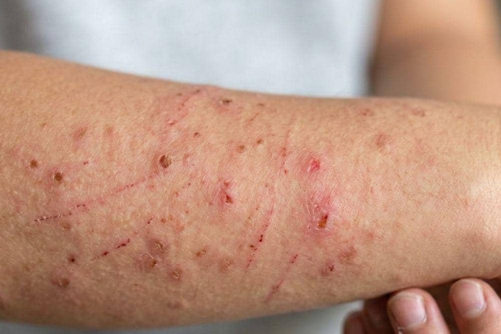 Popmama.com/Alya Putri Abi/AI