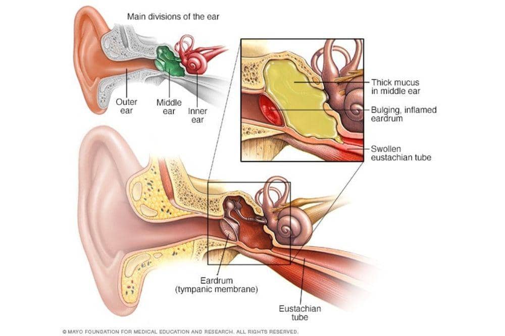 4 Penyebab Telinga Kiri Berdenging Menurut Kesehatan
