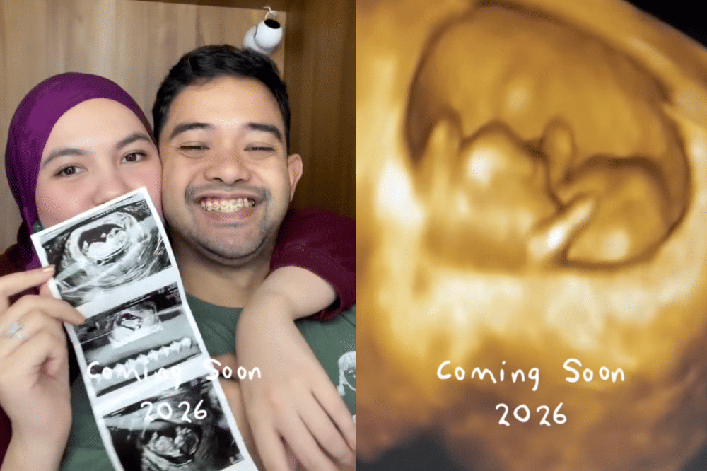 5 Fakta Kehamilan Anizabella Putri, Istri Ryan Adriandhy Sutradara Jumbo