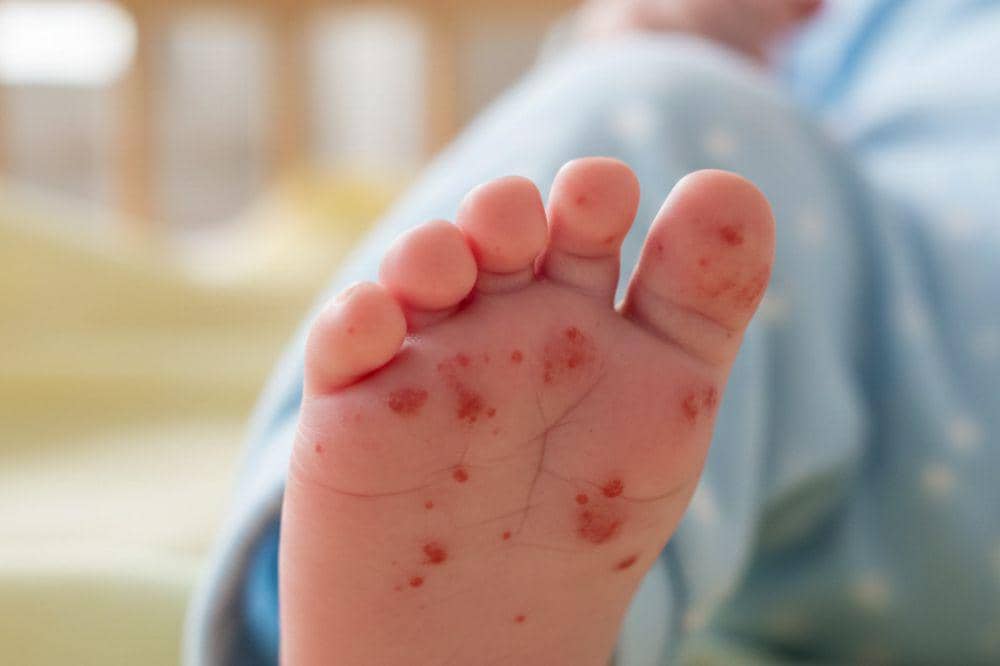 Pomama.com/Alya Putri Abi/ AI