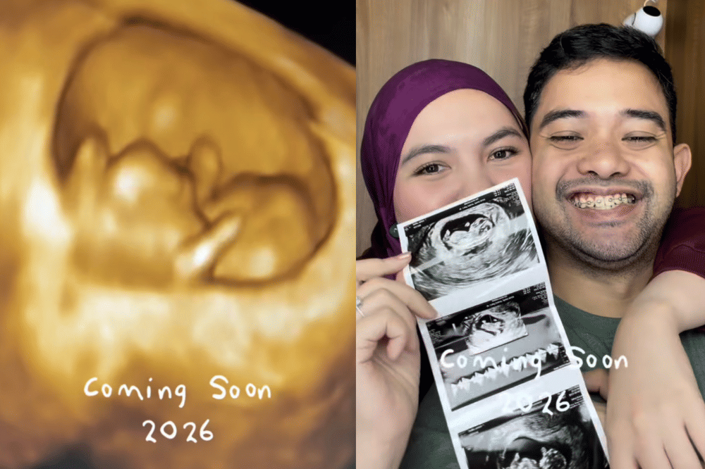 Instagram.com/anizabell93