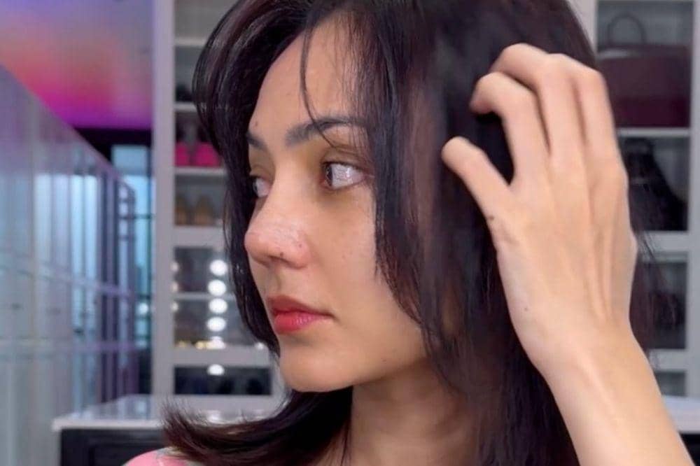 Transformasi Wajah Rina Nose Usai Operasi Hidung di dr. Tompi