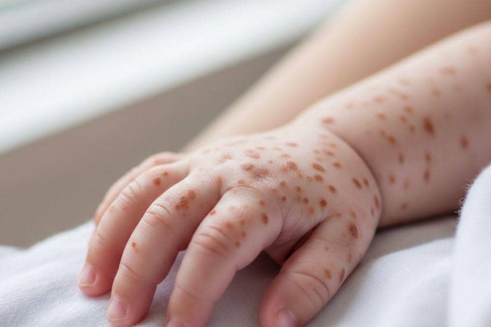 Pomama.com/Alya Putri Abi/ AI