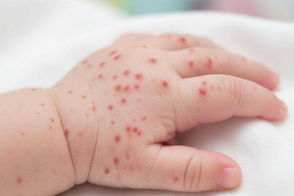 Pomama.com/Alya Putri Abi/ AI