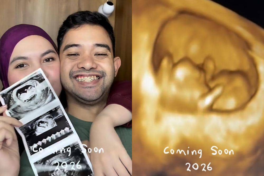 Instagram.com/anizabell93