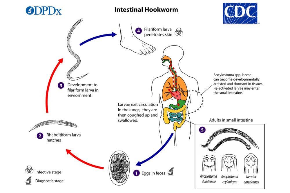 Hookworm_LifeCycle_lg.jpg