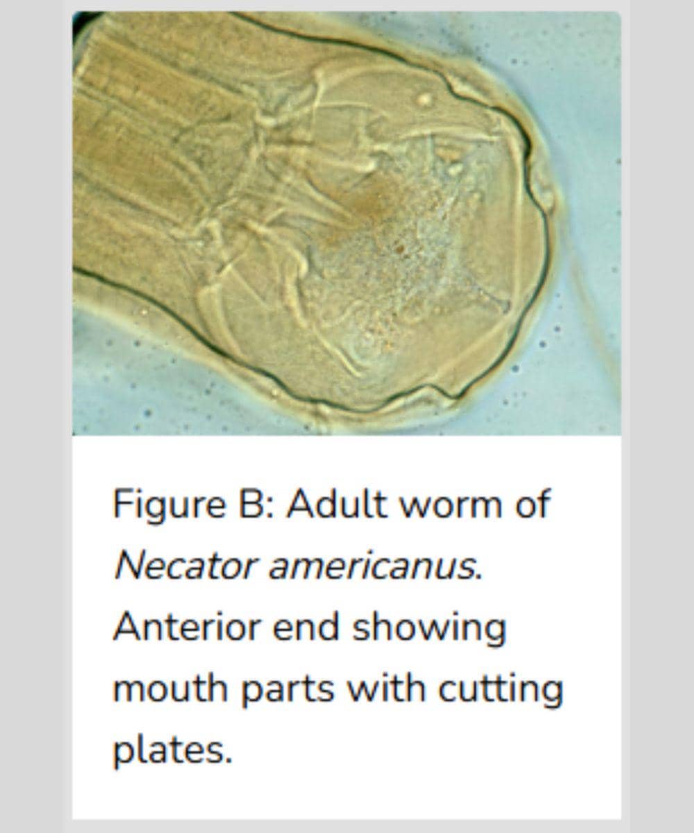Cacing Necator americanus