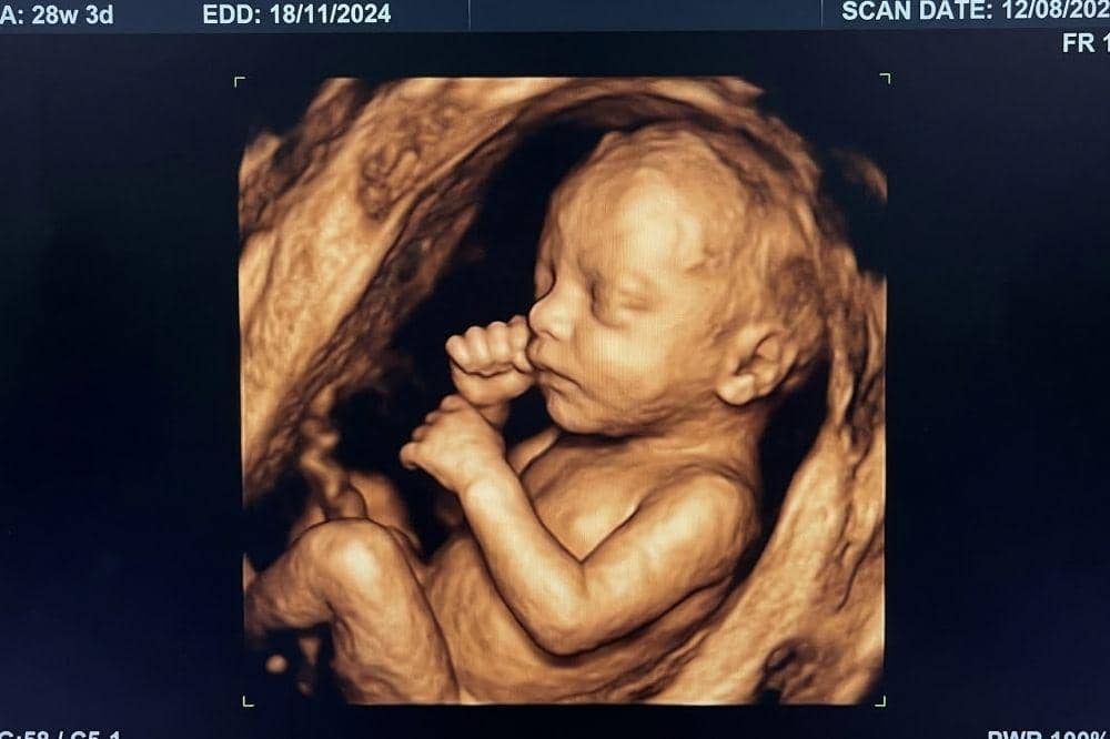 Popmama.com/Dewi Triana Rahmawati/AI