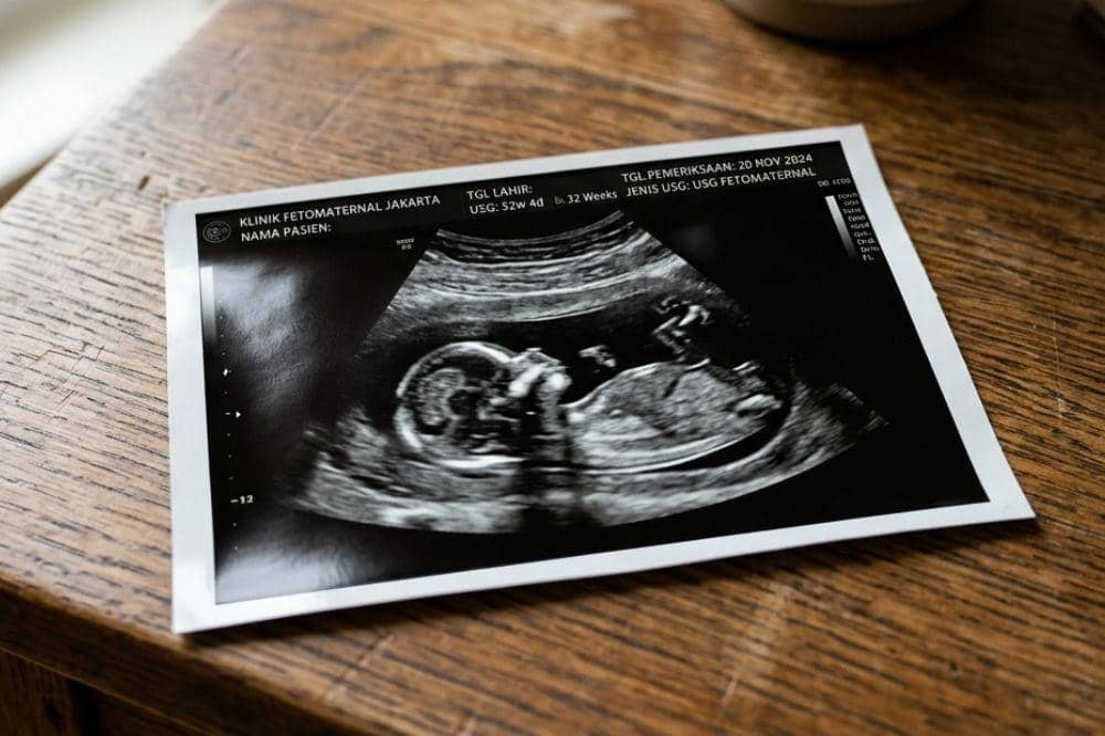 Popmama.com/Alya Putri Abi/AI