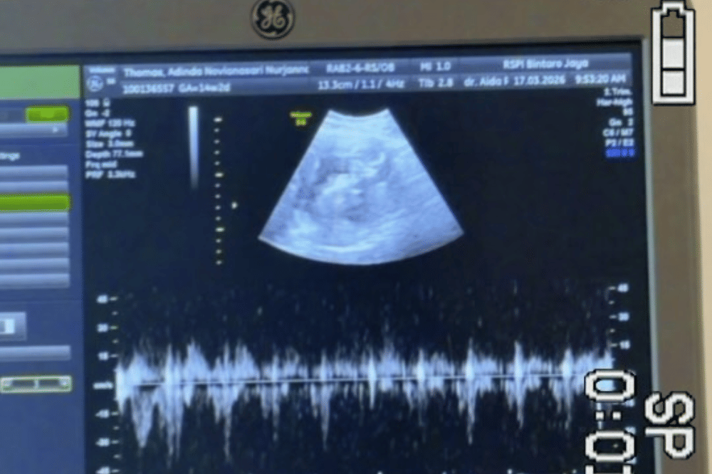 Fakta Kehamilan Adinda Thomas 5.png