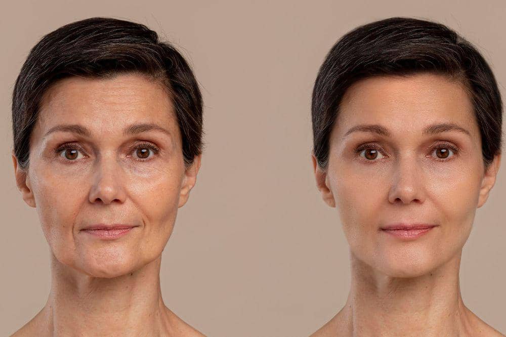 Sering Skip Skincare Malam? Ini Dampaknya ke Kulit