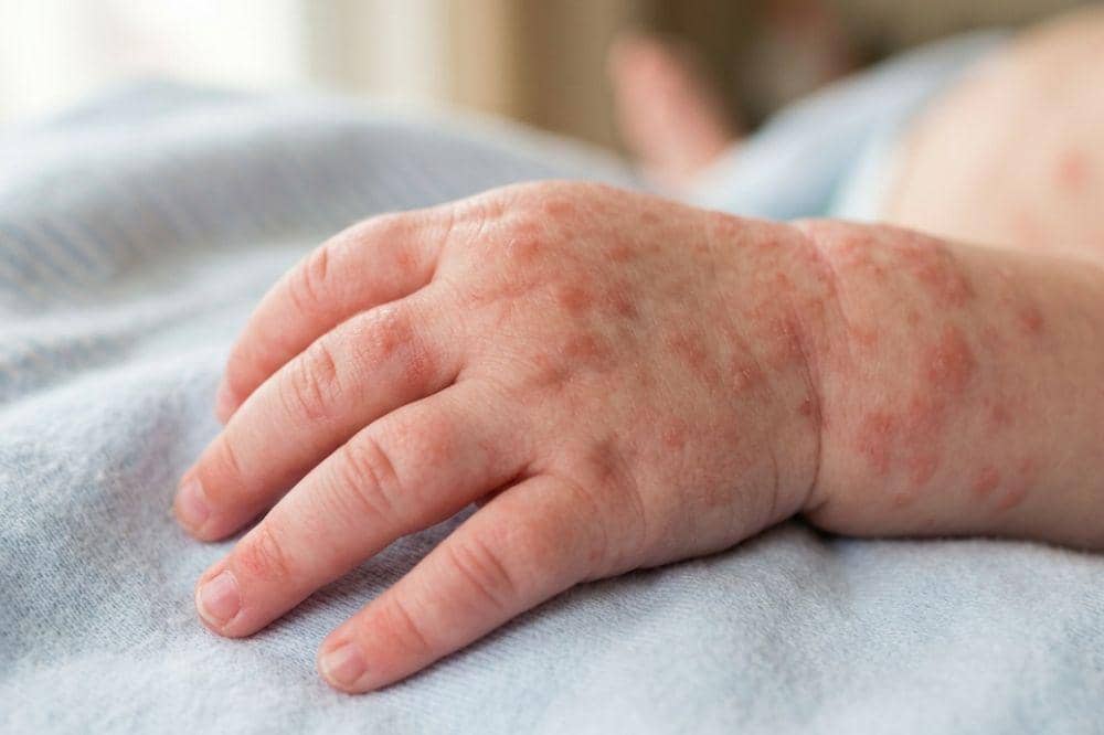 Popmama.com/Alya Putri Abi/AI