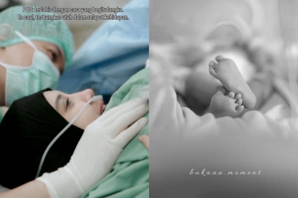 Anak Ketiga Zaskia Sungkar dan Irwansyah Lahir dalam Kondisi Langka