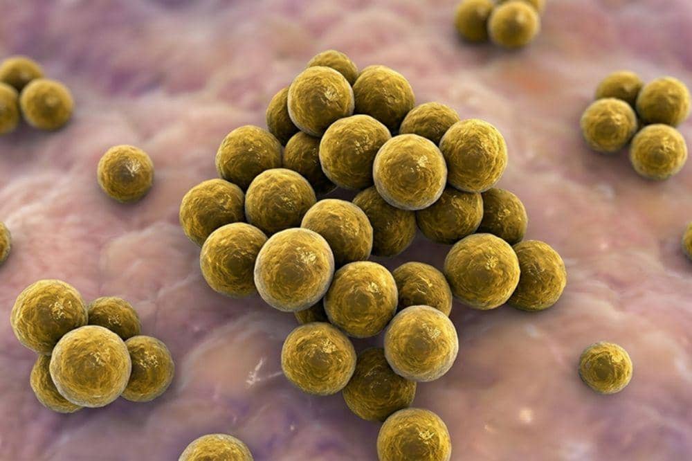 Bakteri staphylococcus aureus
