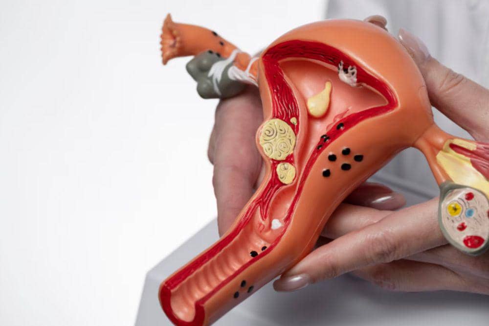 Mengenal 5 Tanda Sembuh dari Kanker Serviks (2).jpg