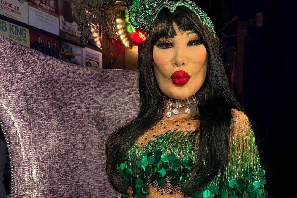 Akibat Suntikan Kecantikan, Wajah Artis Meksiko Kembali Disorot