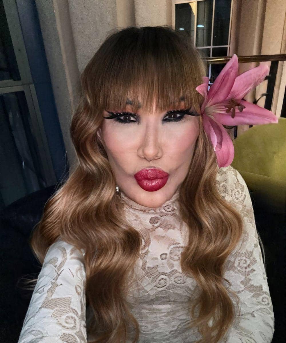 Akibat Suntikan Kecantikan Wajah Artis Meksiko Kembali Disorot 