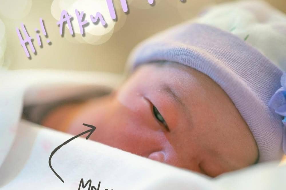 Perjalanan Persalinan Leyla Aderina Melahirkan di Hari Lebaran