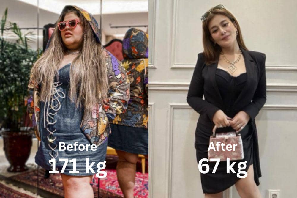 7 Transformasi Shindy Samuel dari 171kg ke 67kg, Langsing Minim Gelambir