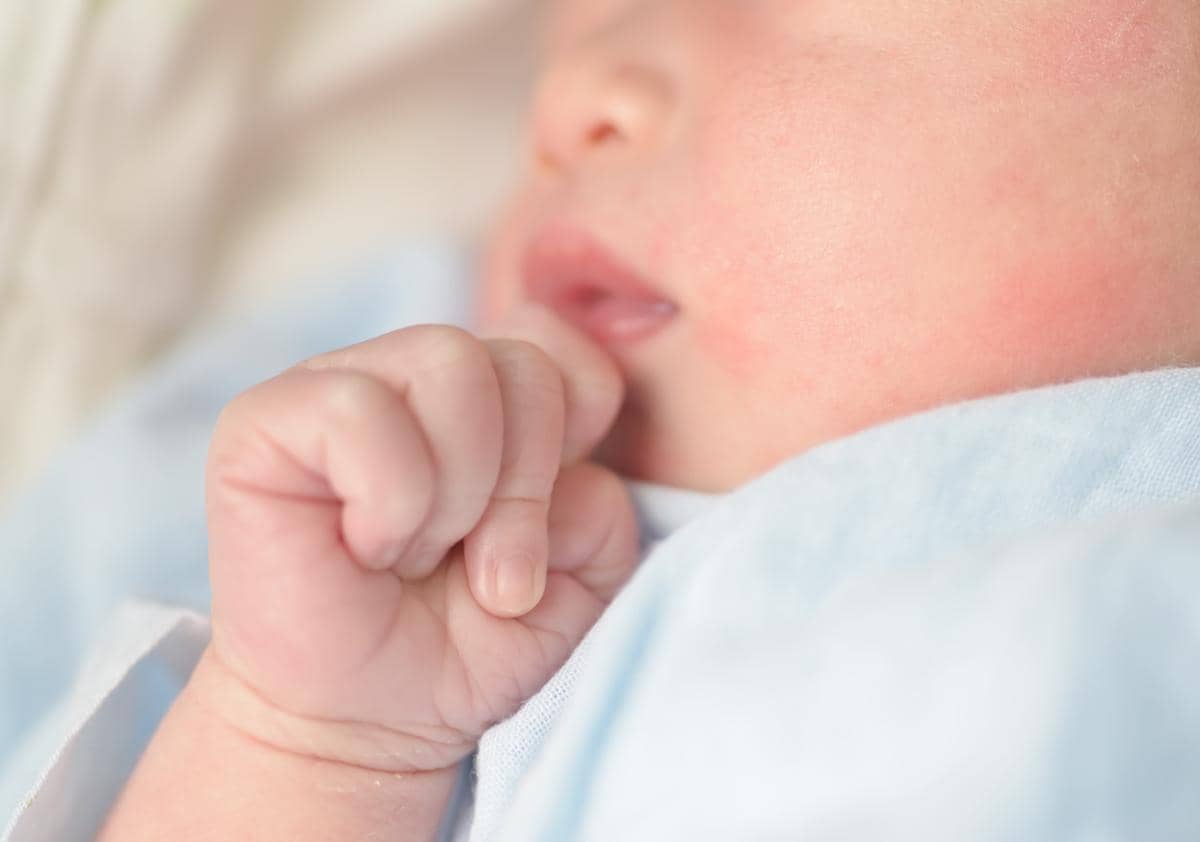 Waspada, Dermatitis Atopik Bisa Ganggu Tumbuh Kembang Anak