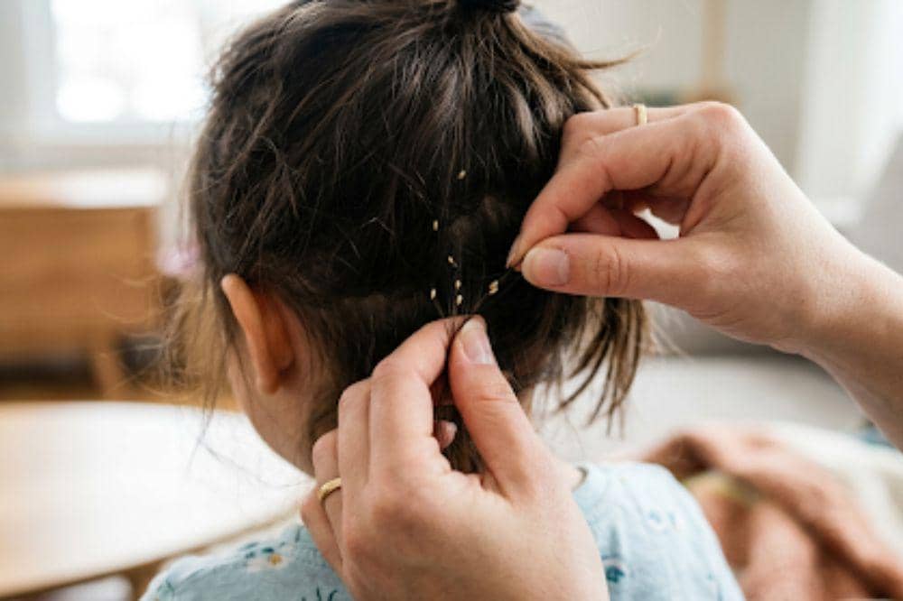 Telur kutu di rambut anak