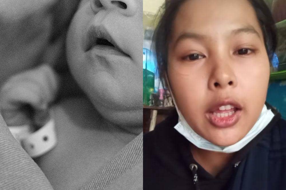 Kronologi Bayi Diduga Hendak Ditukar Usai Dirawat di RSHS Bandung