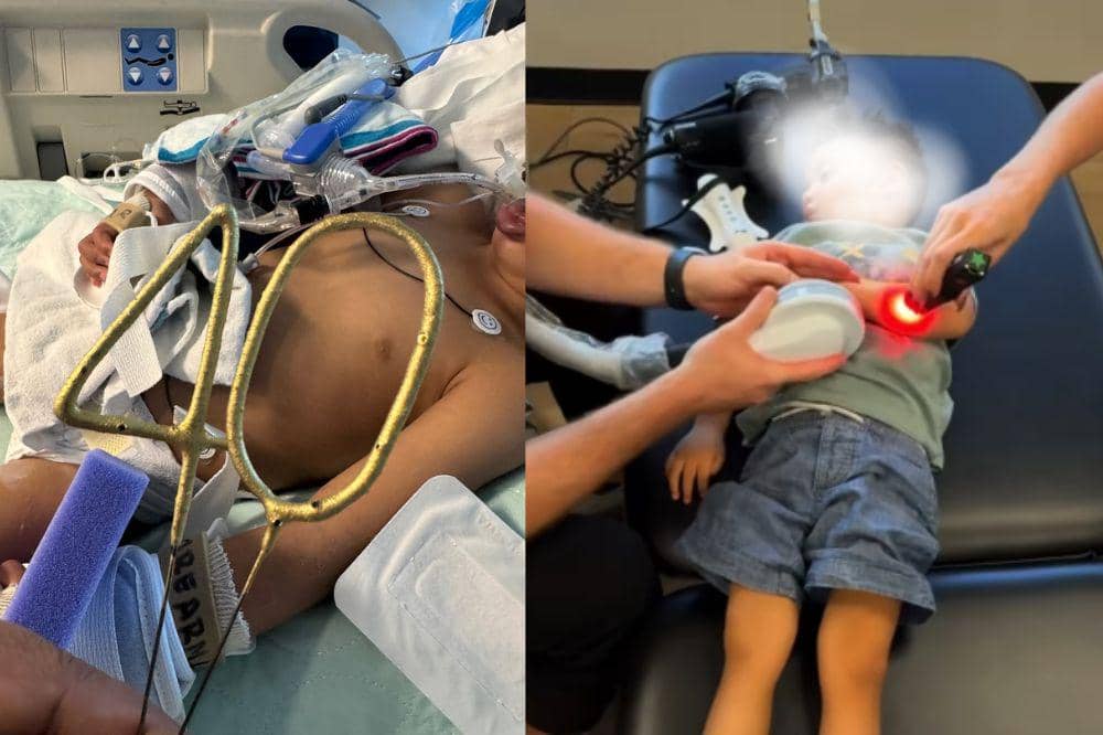 Kisah Enzo, Balita yang Alami Tonic Seizures Setelah Tenggelam di Kolam